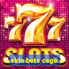 skin bets csgo